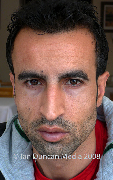 VICTIM OF UNPROVOKED RACIST ATTACK... Ferit Olmez who lost four of his front teeth after being assaulted in a Scarborough nightclub...