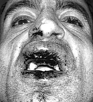 BLOODY AFTERMATH... Photo showing the injuries suffered by Ferit Olmez during the attack...