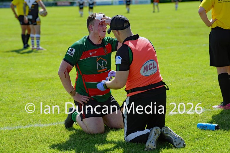 West Bowling player gets treatment for a cut head during the match against Wath Brow hornets. Picture by Ian Duncan.